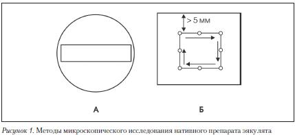 podschet-spermatozoidov-a-kamere-goryaeva